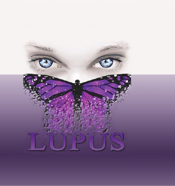 الذئبة الحمراء                                                                                                                                                                                         Systemic Lupus Erythematosus