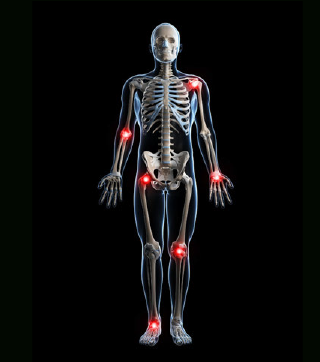 Examples Of Rheumatic