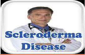 تصلب الجلد                                                                                                                                                                                                    Scleroderma