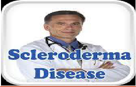 Scleroderma