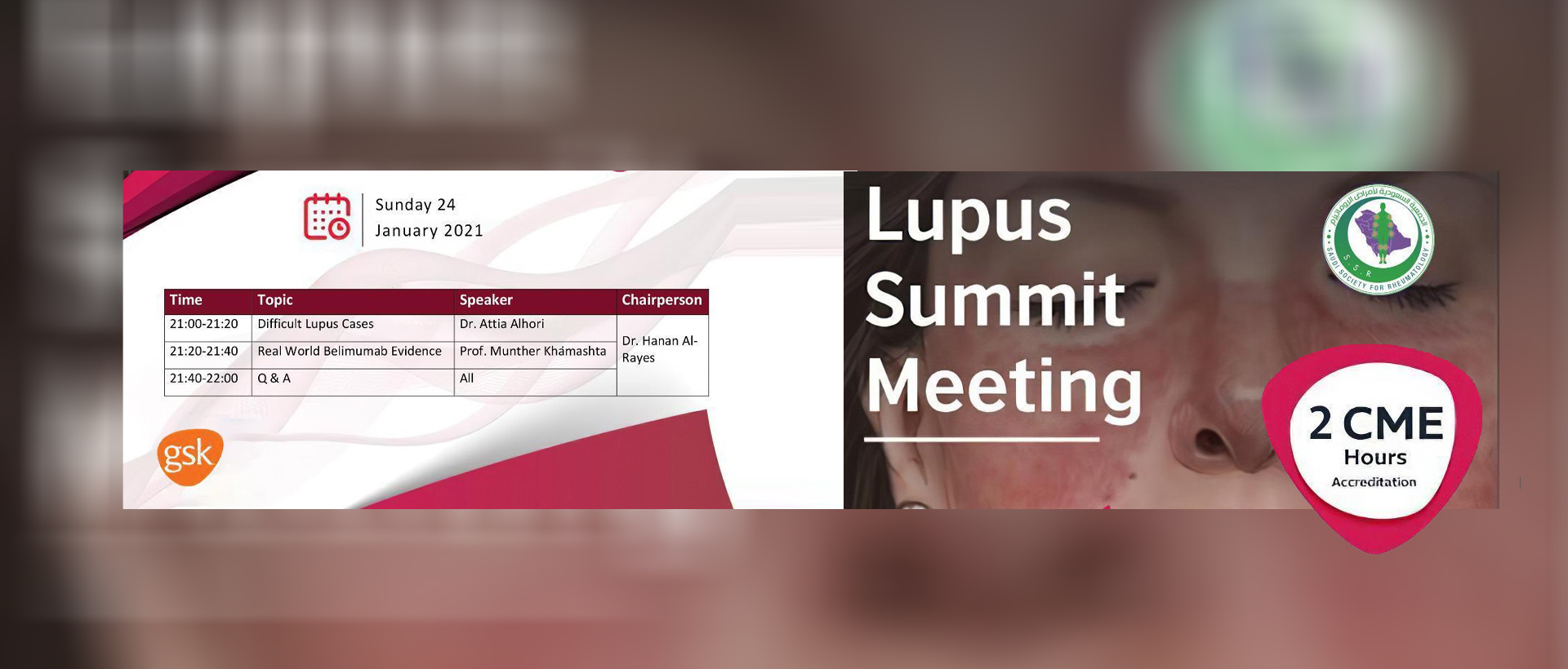 Lupus