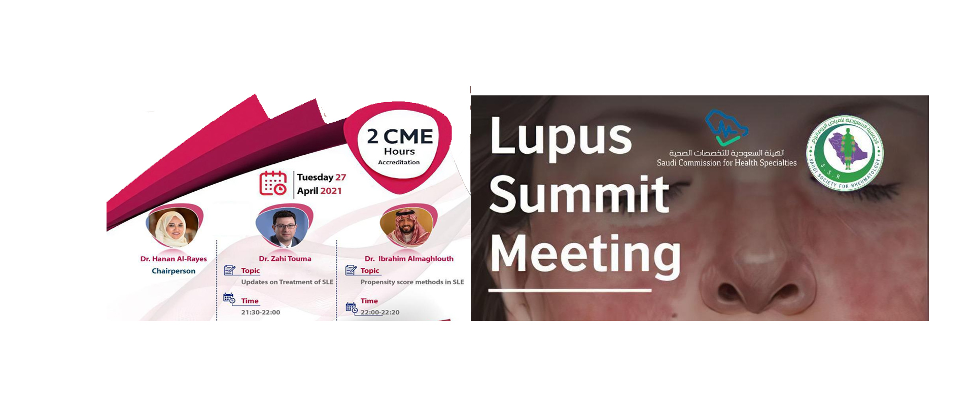 lupus summit meeting